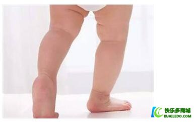 宝宝走路腿不直是O型腿？